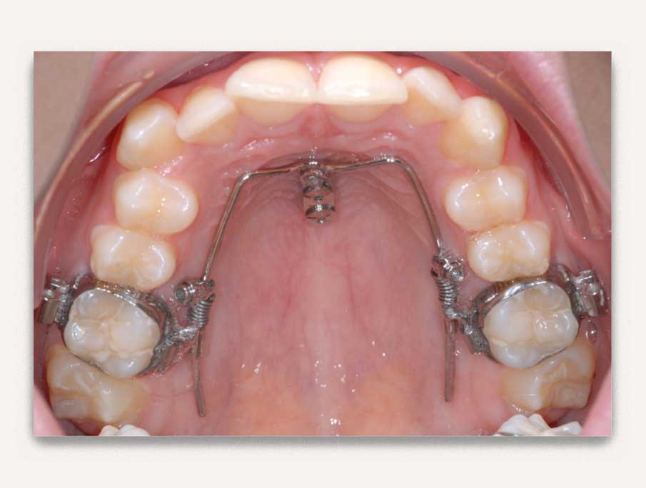 services orthodontics implants - valais