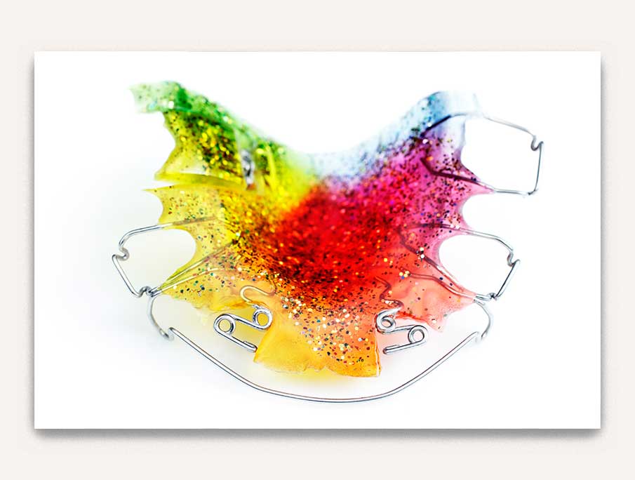 Palatal expansion service - Valais