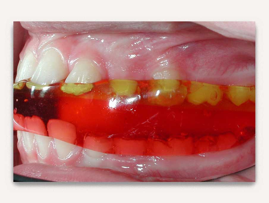 Beyond Smile - Growth modification services