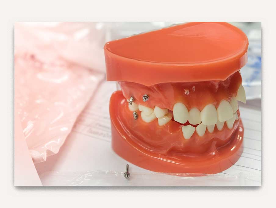 services orthodontics implants - valais