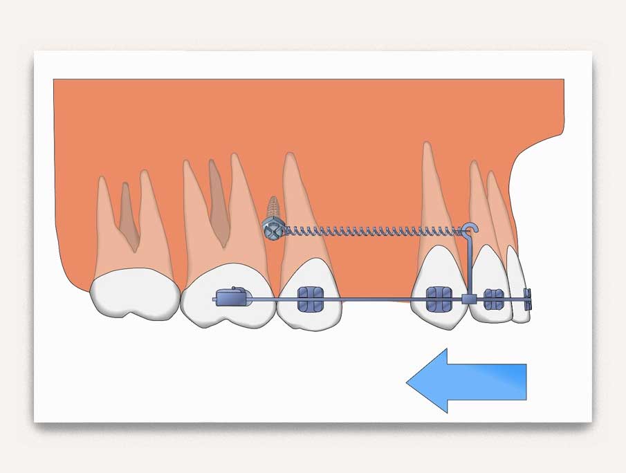 services orthodontics implants - valais